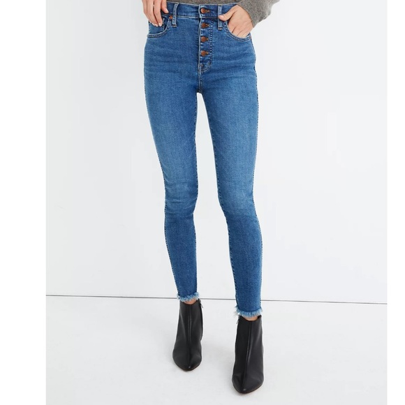 Madewell 10" High-Rise Skinny Jeans in Mackey Wash: Button-Front Edition - Picture 2 of 9